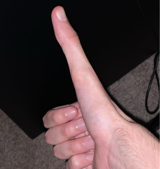 thumb.png