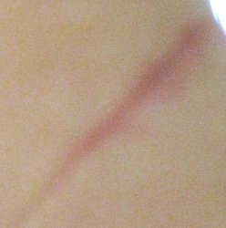 forearm.jpg