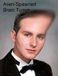 tumor.jpg