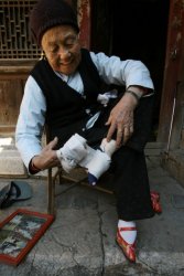 Messed up feet 03.jpg