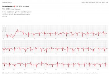 ECG12-9.jpg