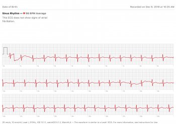 ECG 2018-12-09 10_25-0500.jpg