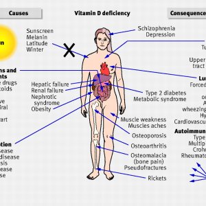 vitamin-d-def.jpg