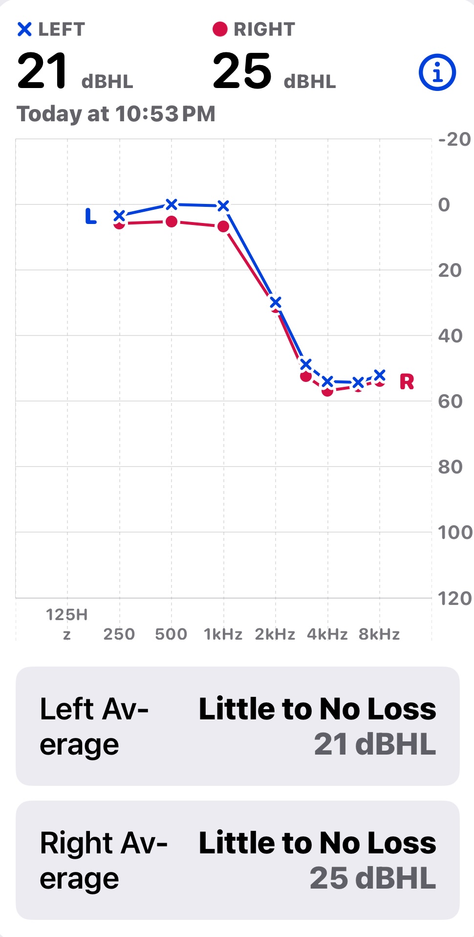 JMS audiogram Oct 28 2024, taken using AirPods Pro 2 and the Health app's Hearing Test.jpg