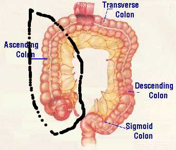 colon-1.jpg