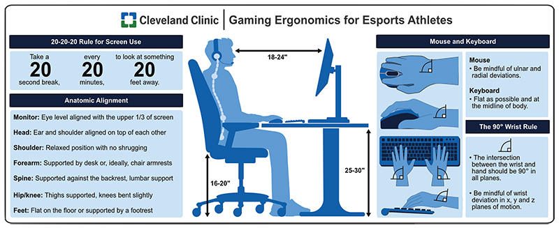 cc-esports-ergonomics.jpg