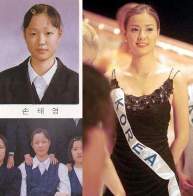 korean+artress+plastic+surgery+1.jpg