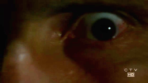 3x20eye.png